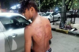 GRP थाने में युवक को थर्ड डिग्री