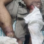 लाइन मैन के साथ बड़ा हादसा