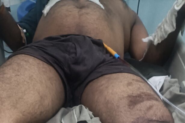 लाइन मैन के साथ बड़ा हादसा